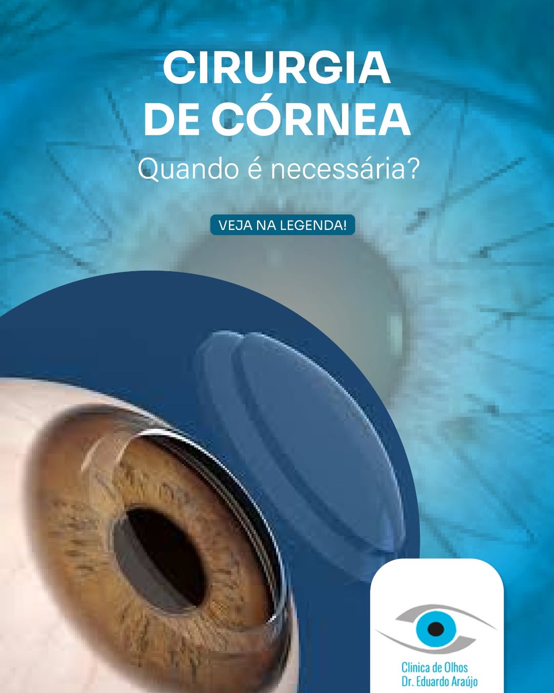 Quando é necessária?