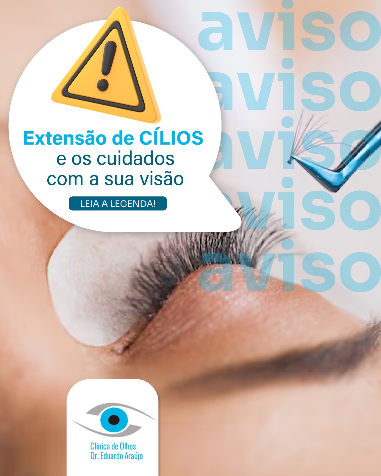 Extensão de cílios e os cuidados com sua visão