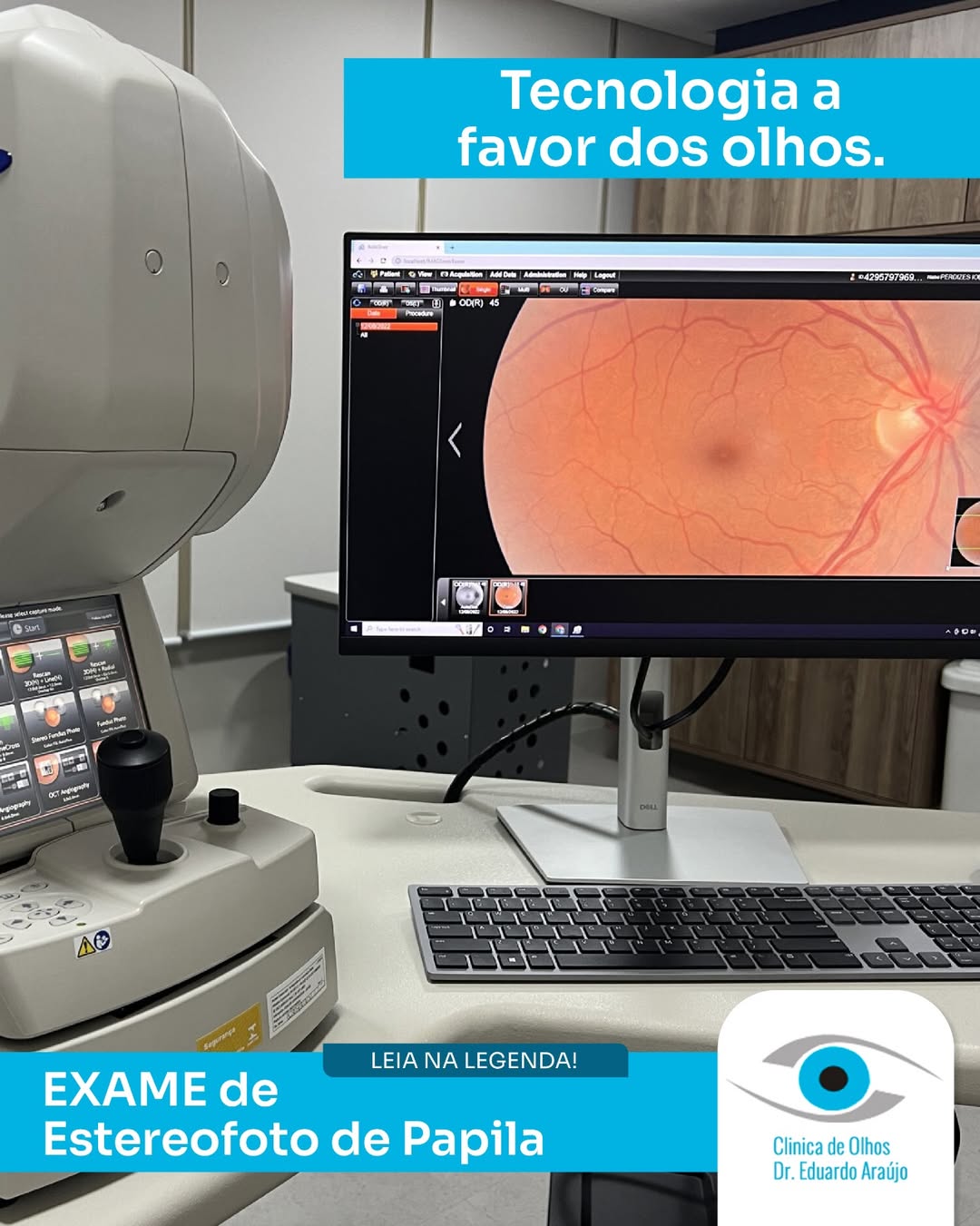 Tecnologia a favor dos olhos