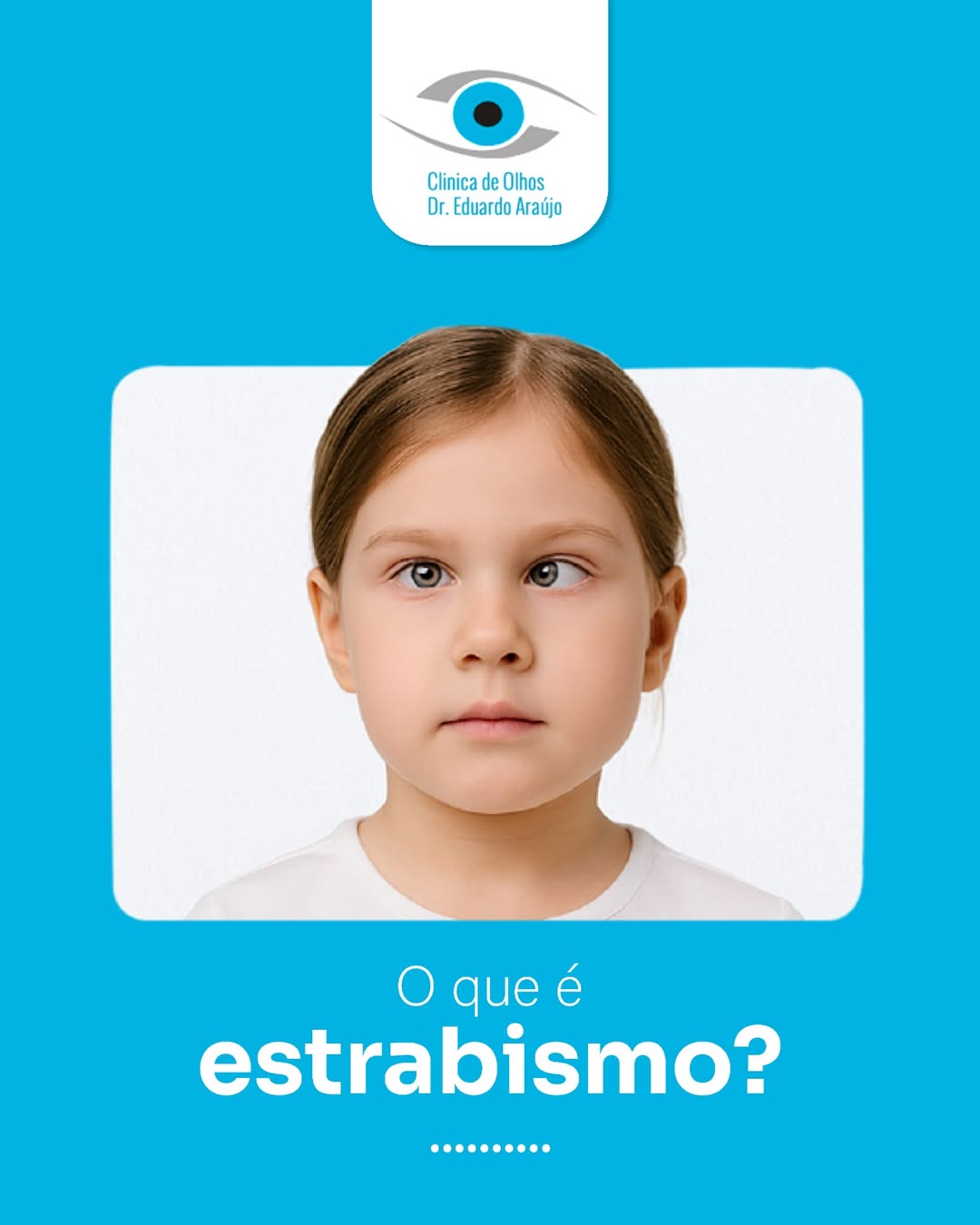 Oque é estrabismo?